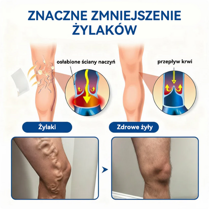 🤩🇵🇱👨‍⚕️✅TAILEDEN® VeinEase Plastry z Mikronakłuciami⚡Natychmiastowa ulga, długotrwałe rezultaty