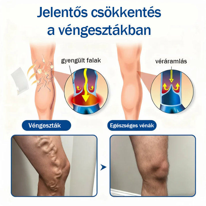 🎁Csak 5 doboz maradt! Extra 50%-os kedvezményt kínálunk! Most alakítsd ki magad, egészséges életet élj. Ne hagyd, hogy második alkalommal kerüljön előre – most cselekedj!