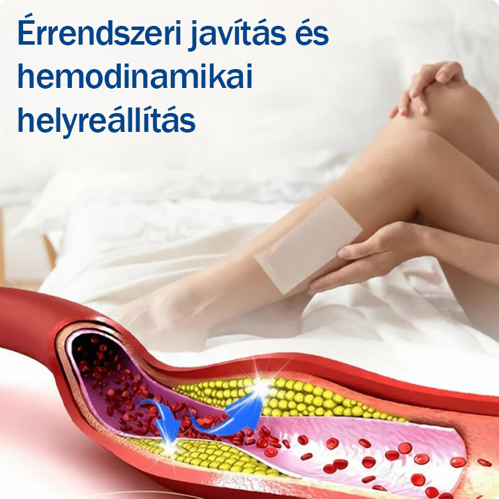 🇭🇺👨‍⚕️✅TAILEDEN® VeinEase Mikrotűs Kezelő Tapasz⚡Azonnali Megkönnyebbülés, Hosszú Távú Eredmények
