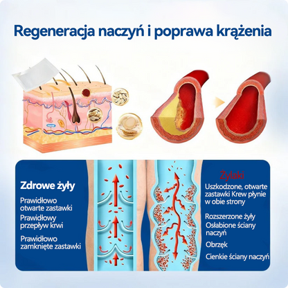 🤩🇵🇱👨‍⚕️✅TAILEDEN® VeinEase Plastry z Mikronakłuciami⚡Natychmiastowa ulga, długotrwałe rezultaty